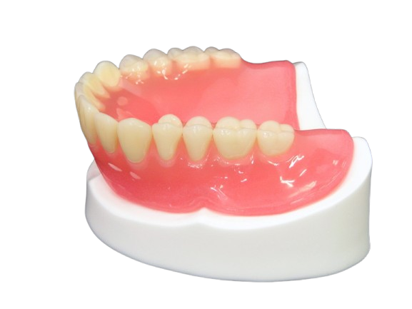 コンフォートソケット（部分入れ歯）