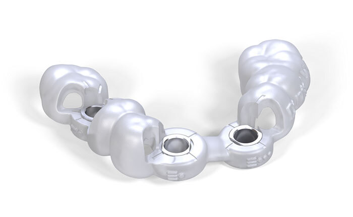 すべての症例でサージカルガイドを使用（使用率100%）