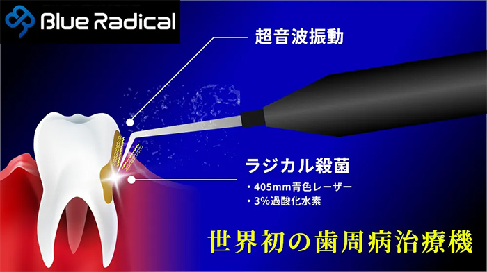 ブルーラジカル（P-01）治療