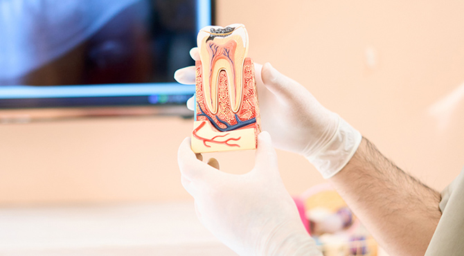 米国式根管治療